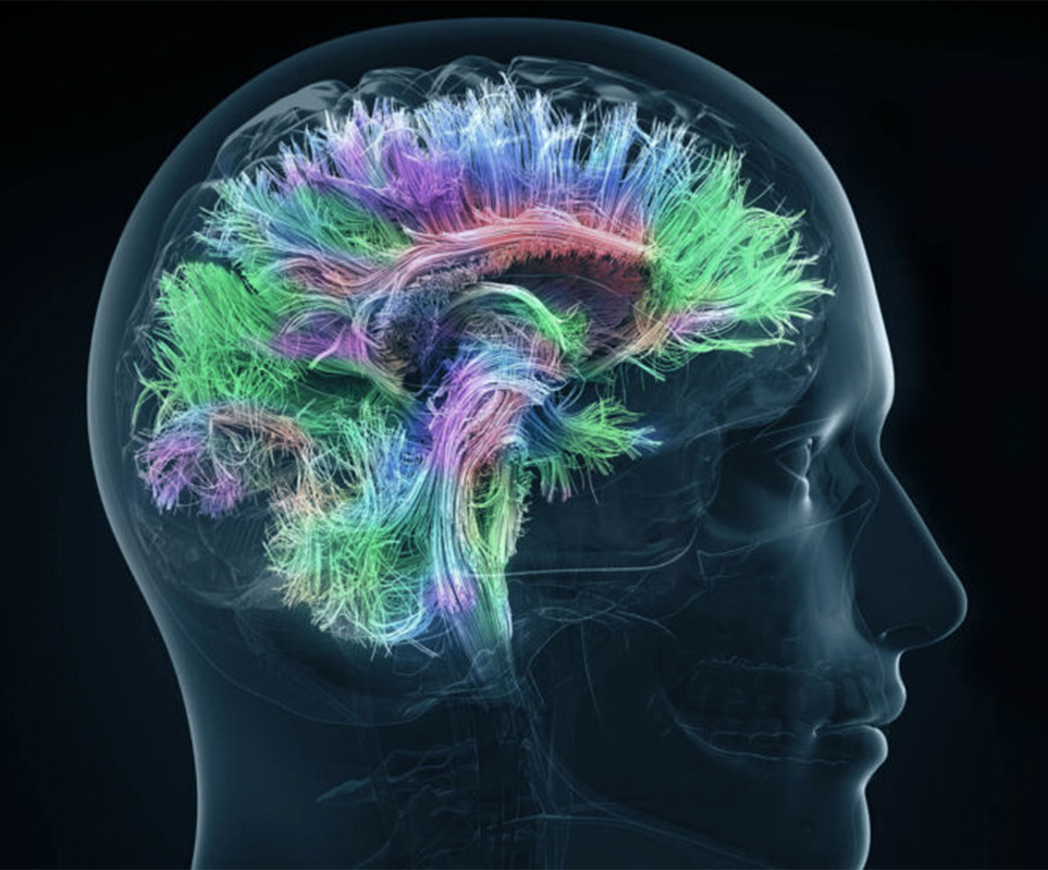 Neuroradiologia interventistica